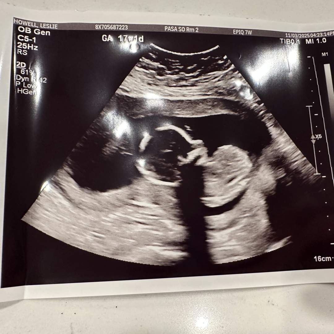 Photo shared by Leslie for their Babylist baby registry.