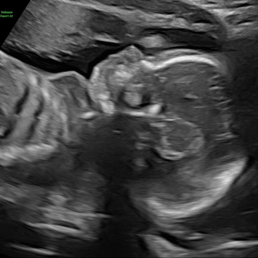 Photo shared by Wystria for their Babylist baby registry.