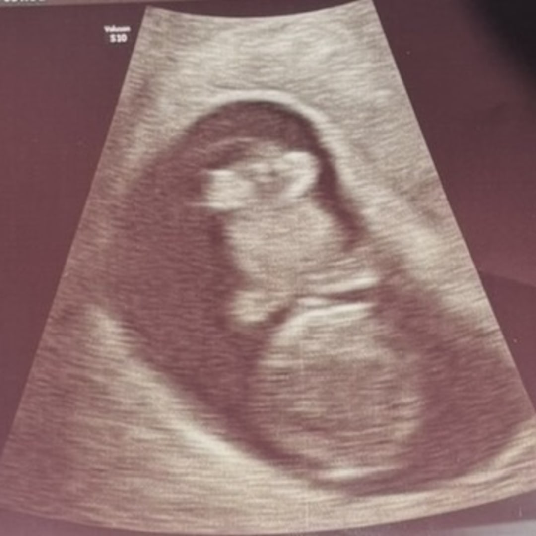 Photo shared by Hannah for their Babylist baby registry.