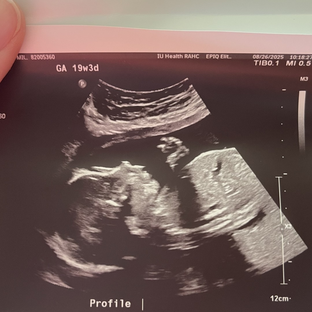 Photo shared by Brittany for their Babylist baby registry.