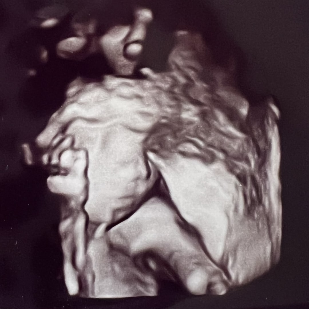 Photo shared by Brooke for their Babylist baby registry.