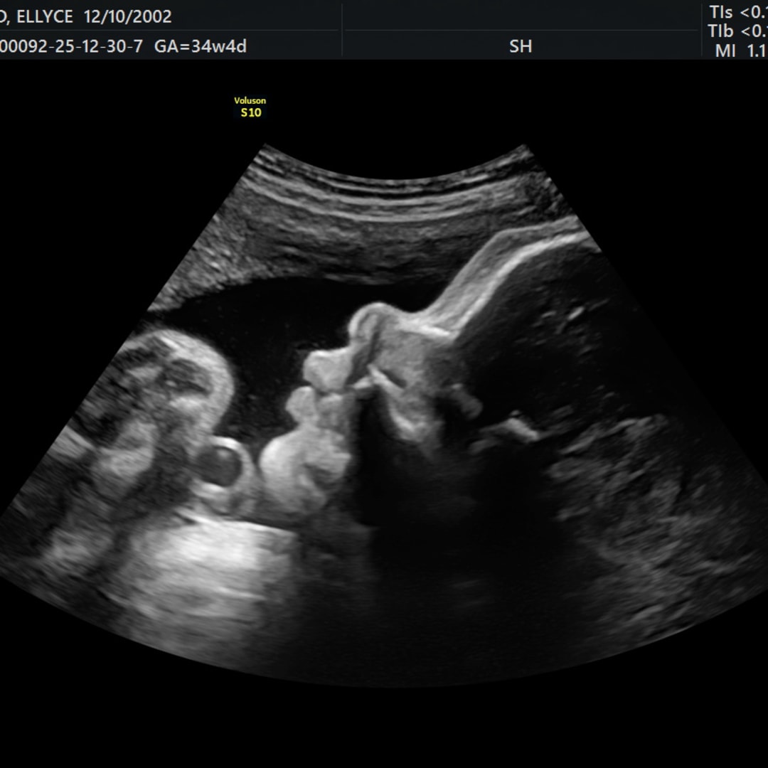 Photo shared by Ellyce for their Babylist baby registry.