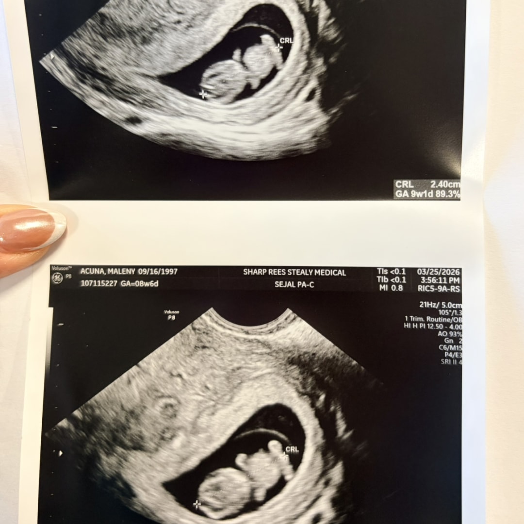 Photo shared by Maleny for their Babylist baby registry.