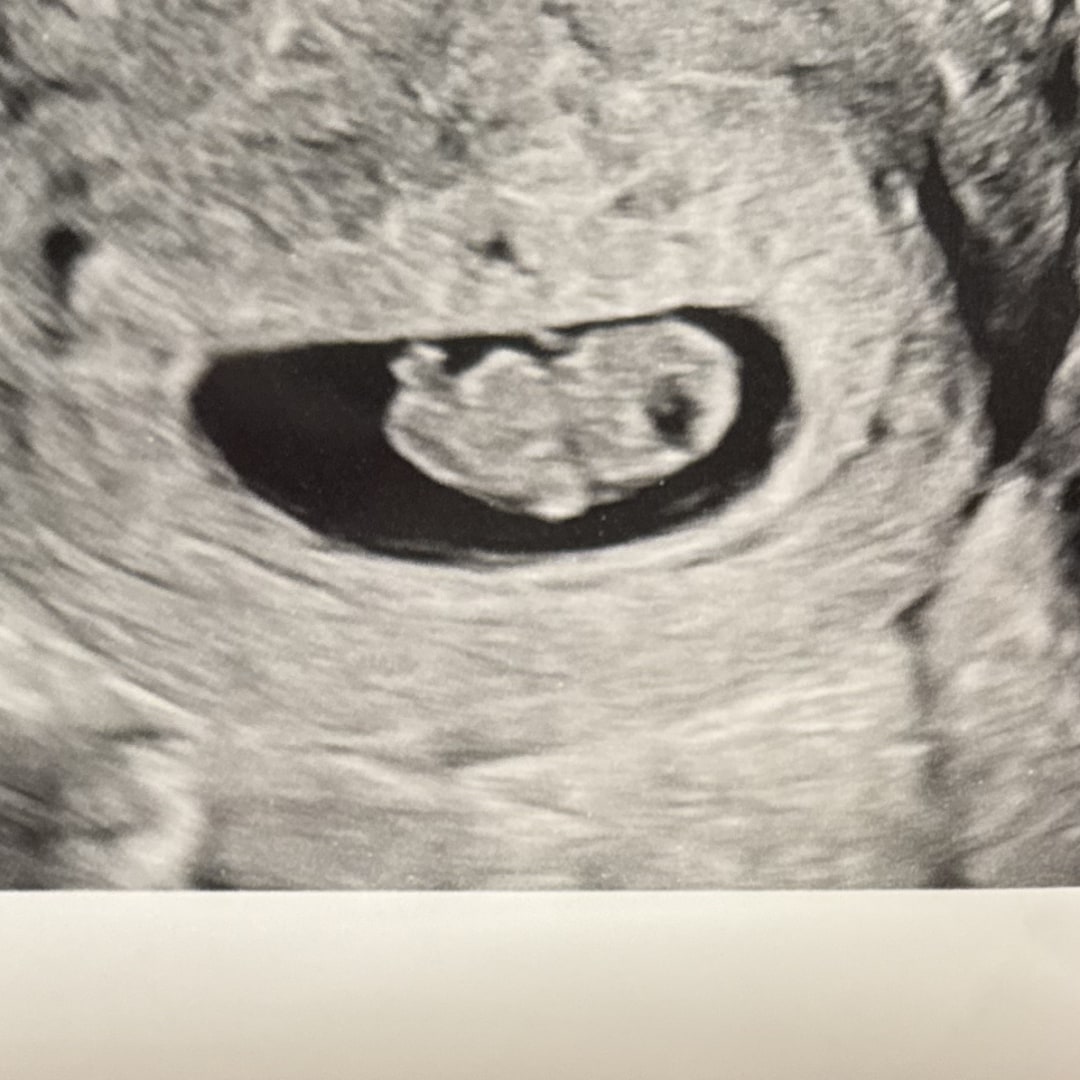 Photo shared by Brittaney for their Babylist baby registry.