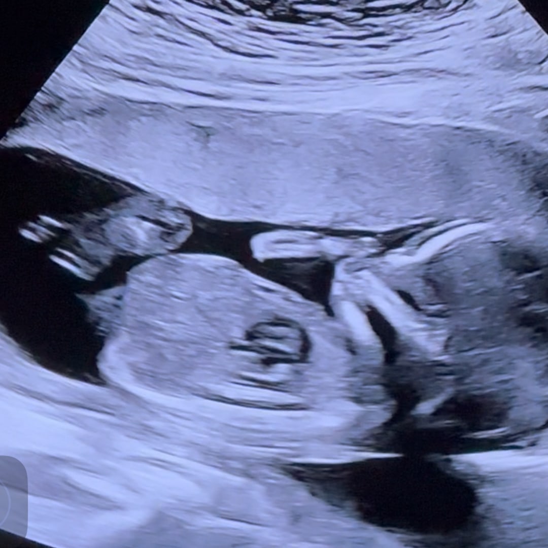 Photo shared by Eden for their Babylist baby registry.