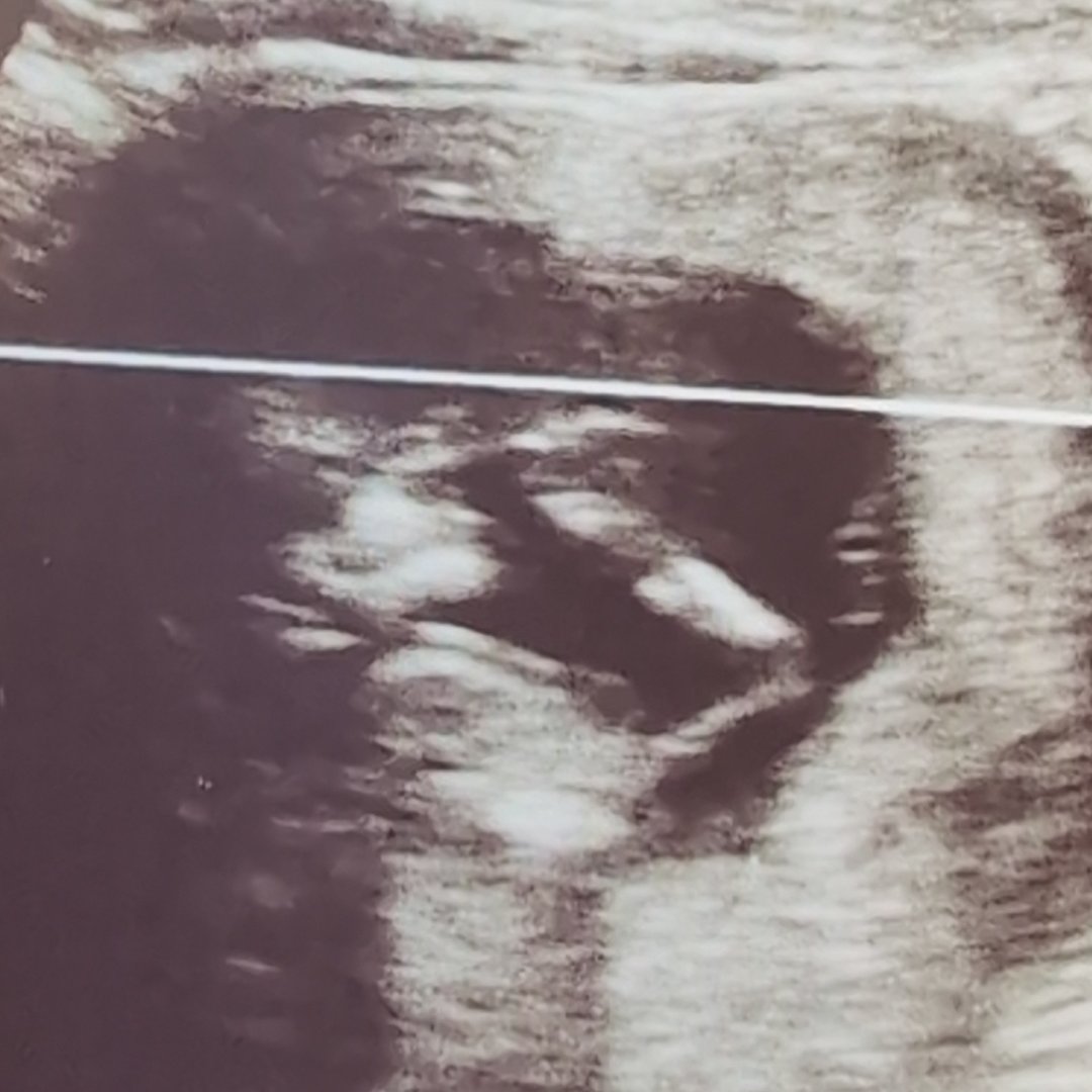 Photo shared by Sarah for their Babylist baby registry.