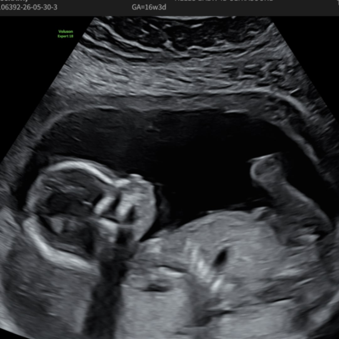 Photo shared by Madi for their Babylist baby registry.