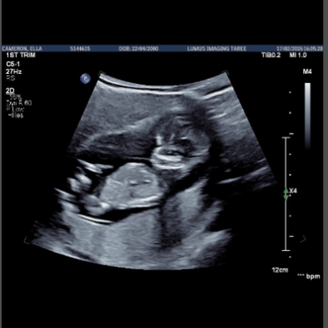 Photo shared by Ella for their Babylist baby registry.