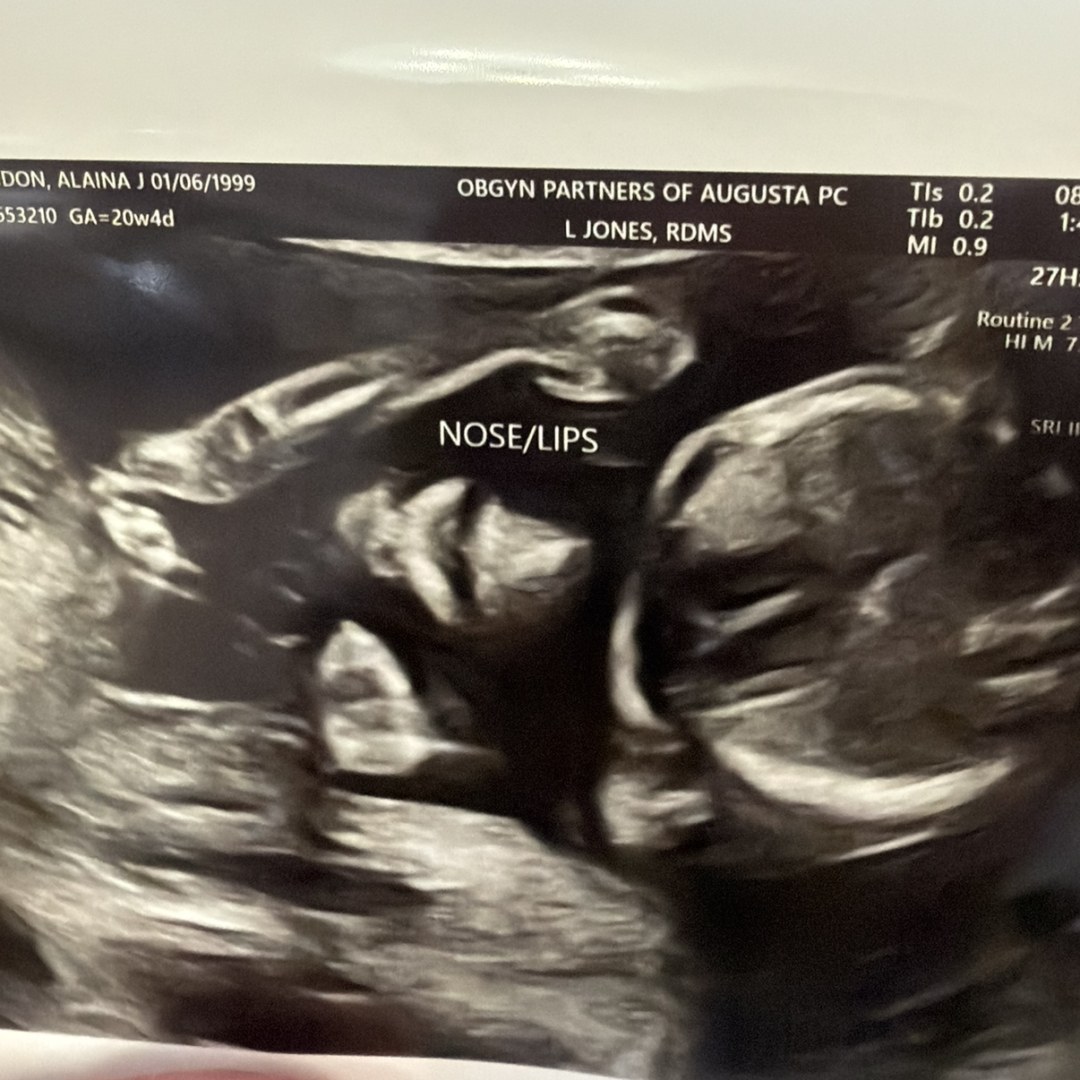 Photo shared by Alaina for their Babylist baby registry.