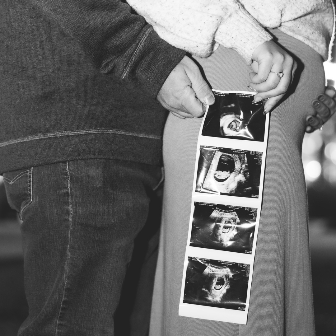 Photo shared by Carrington for their Babylist baby registry.