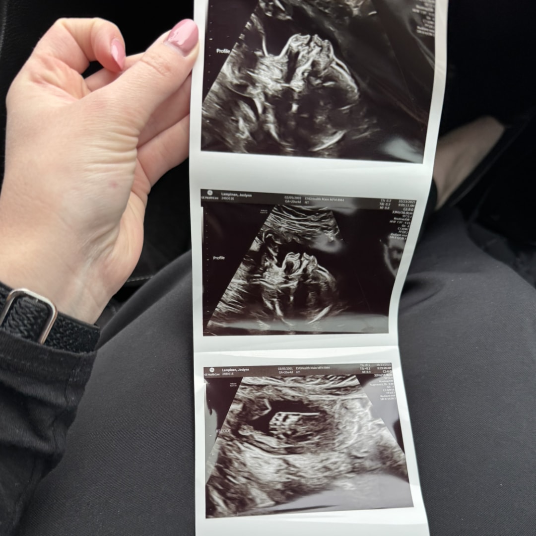 Photo shared by Joslynn for their Babylist baby registry.