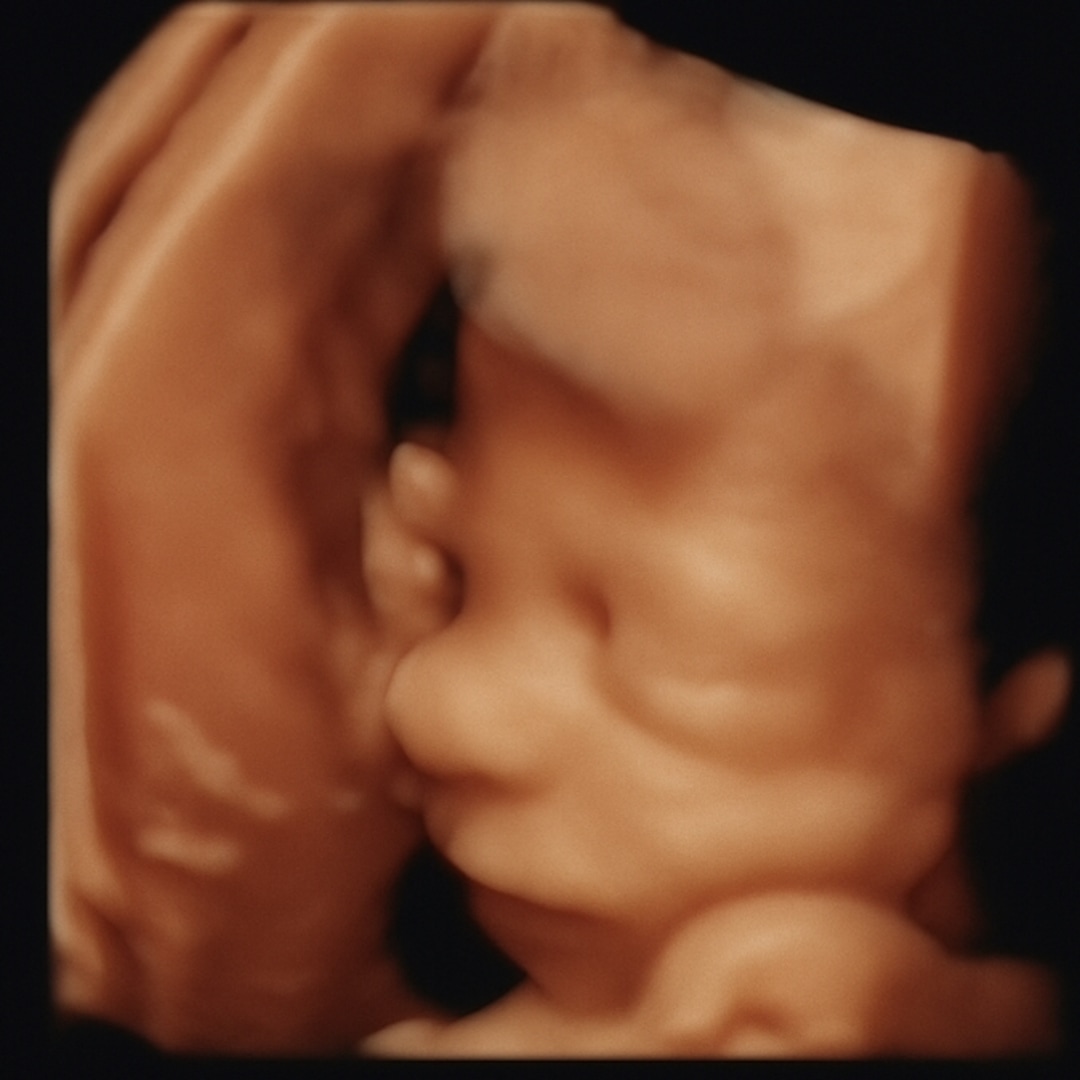 Photo shared by Blakeley for their Babylist baby registry.