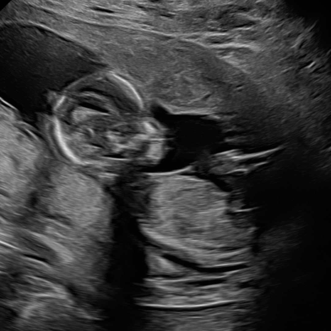 Photo shared by Emily for their Babylist baby registry.