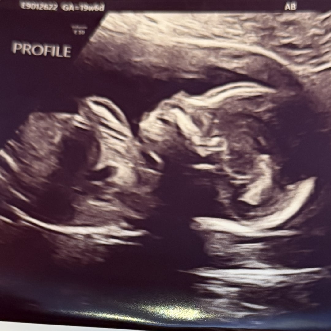 Photo shared by Allison for their Babylist baby registry.