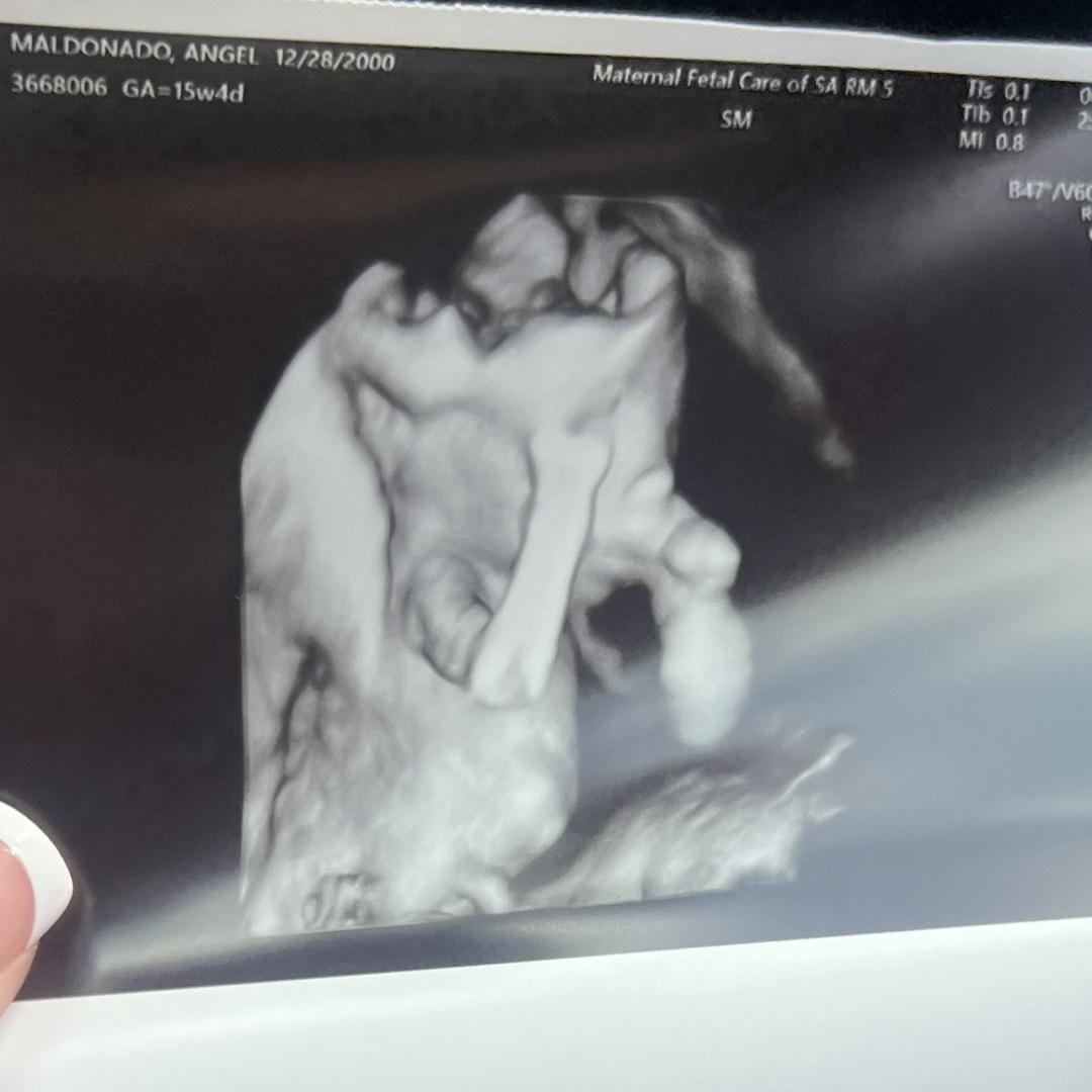 Photo shared by Angel for their Babylist baby registry.