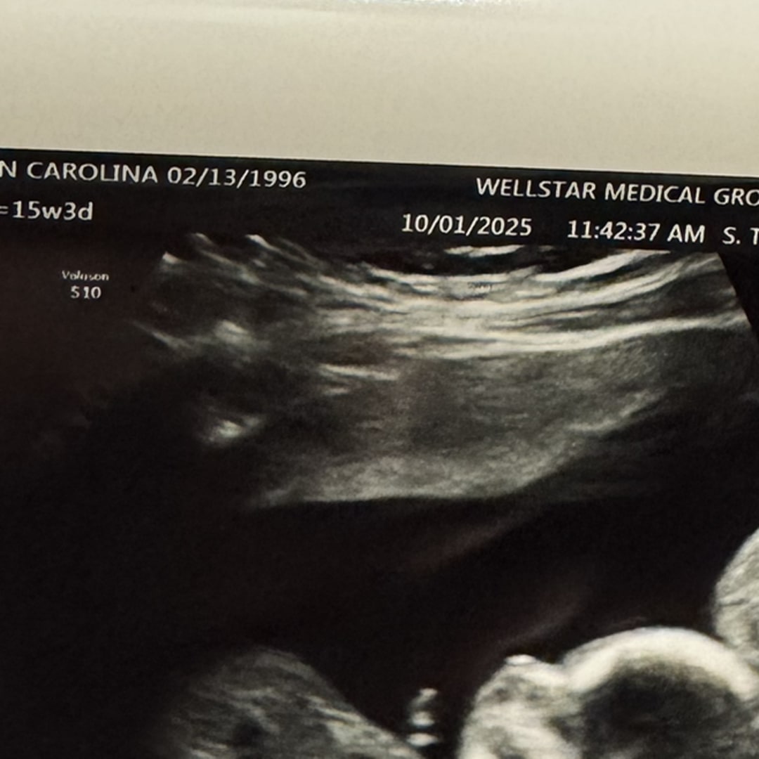 Photo shared by Carolina for their Babylist baby registry.