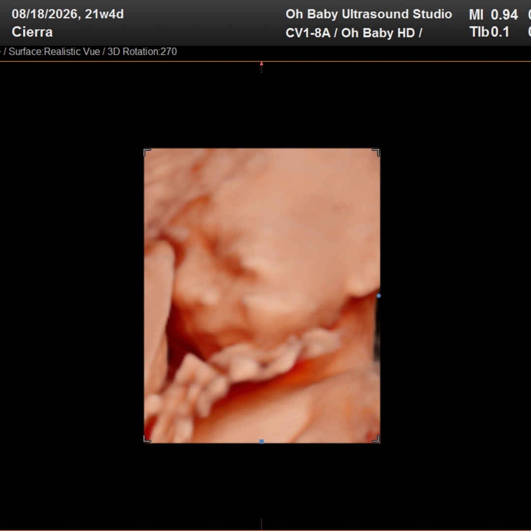 Photo shared by Cierra for their Babylist baby registry.