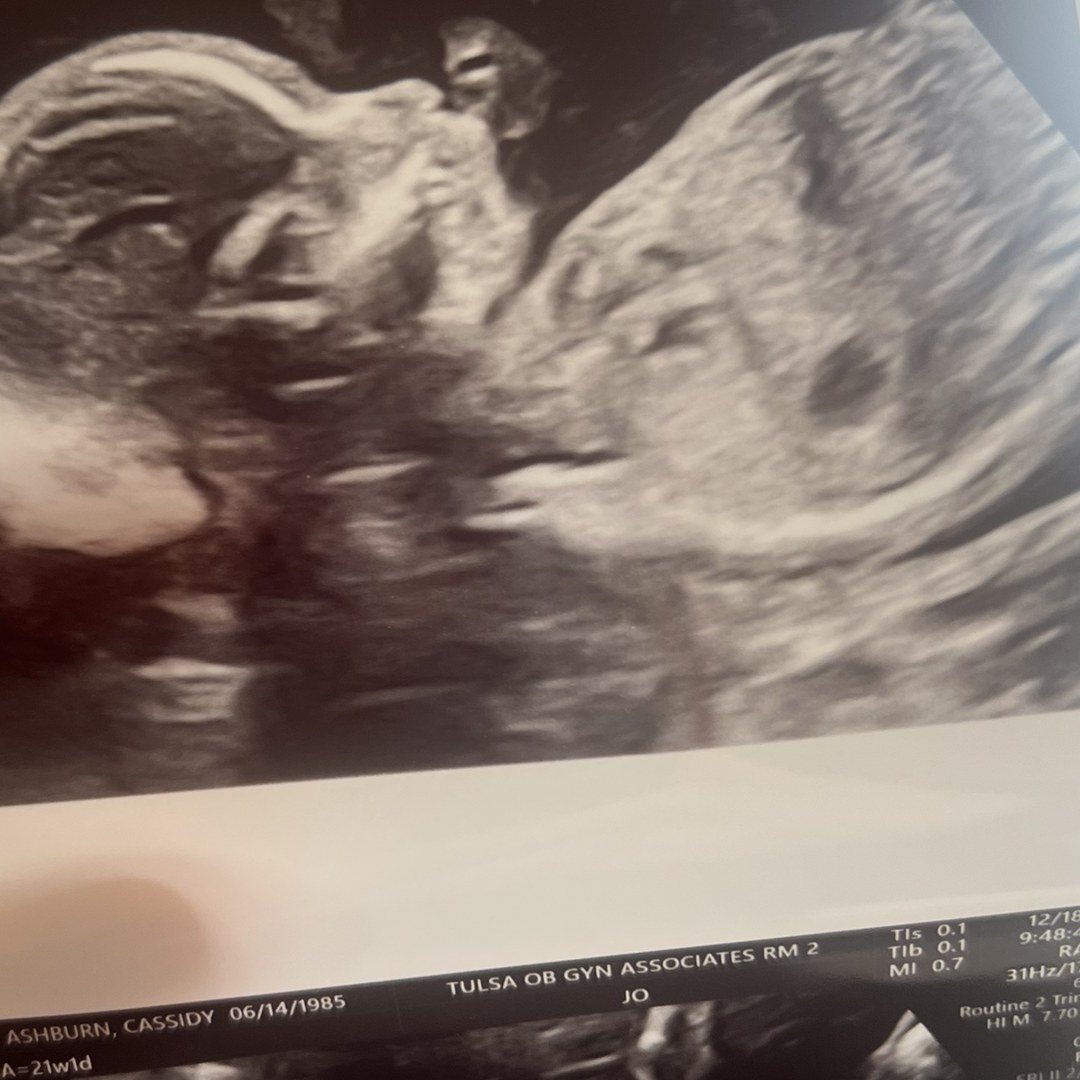 Photo shared by Cassidy for their Babylist baby registry.