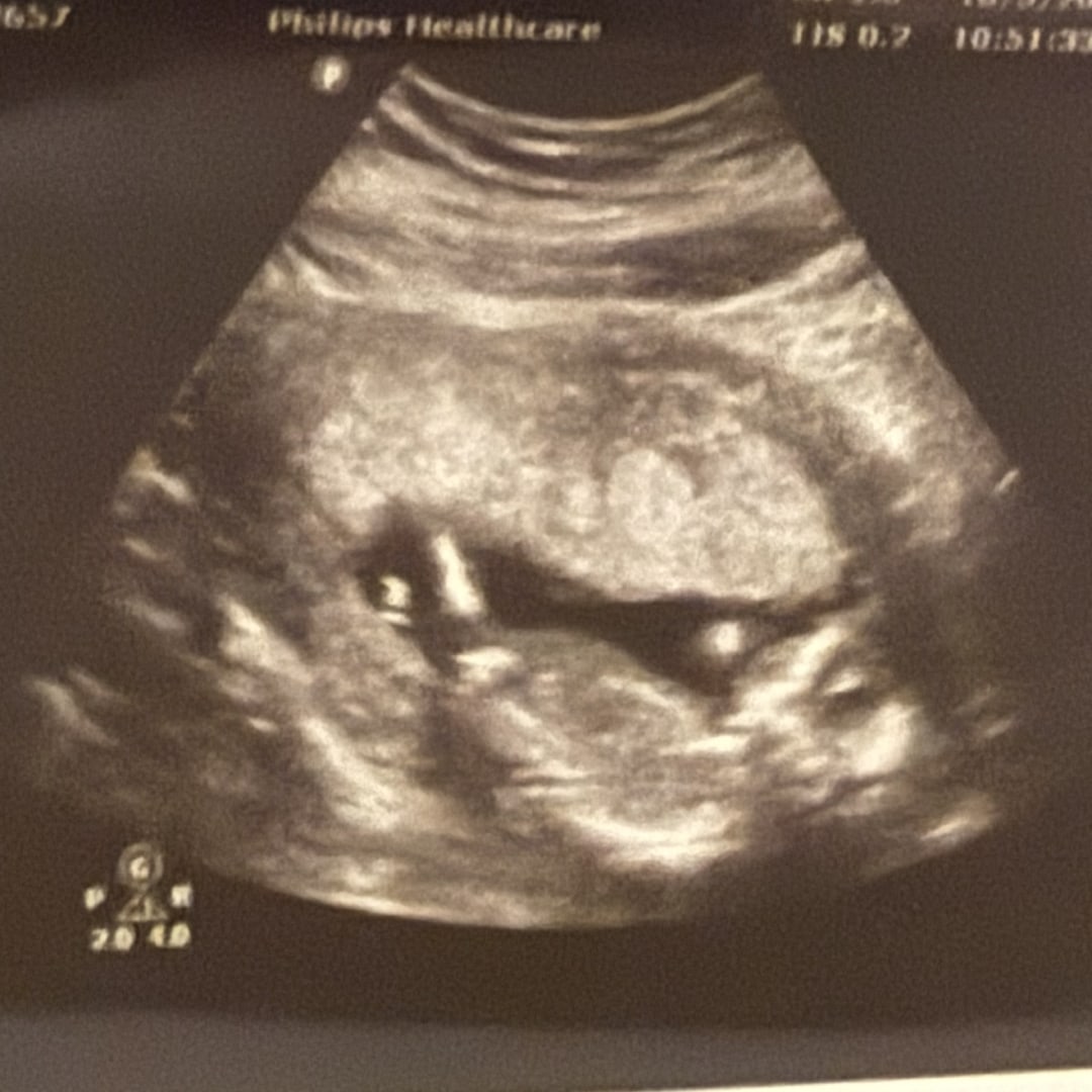 Photo shared by A’lexis for their Babylist baby registry.