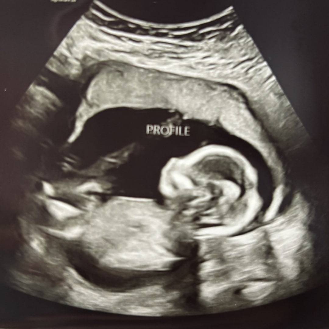Photo shared by Lindsey for their Babylist baby registry.