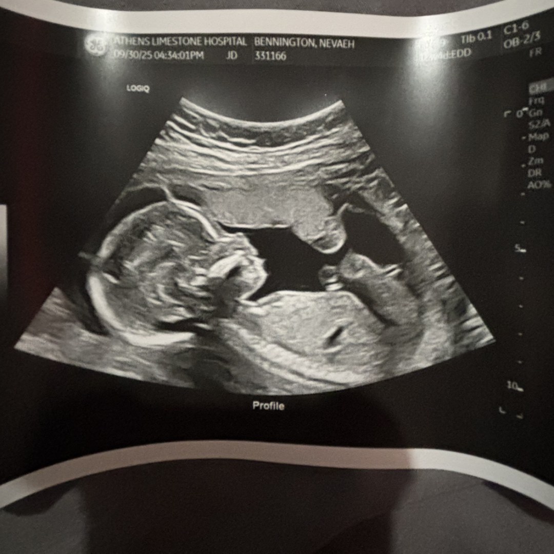 Photo shared by Nevaeh for their Babylist baby registry.