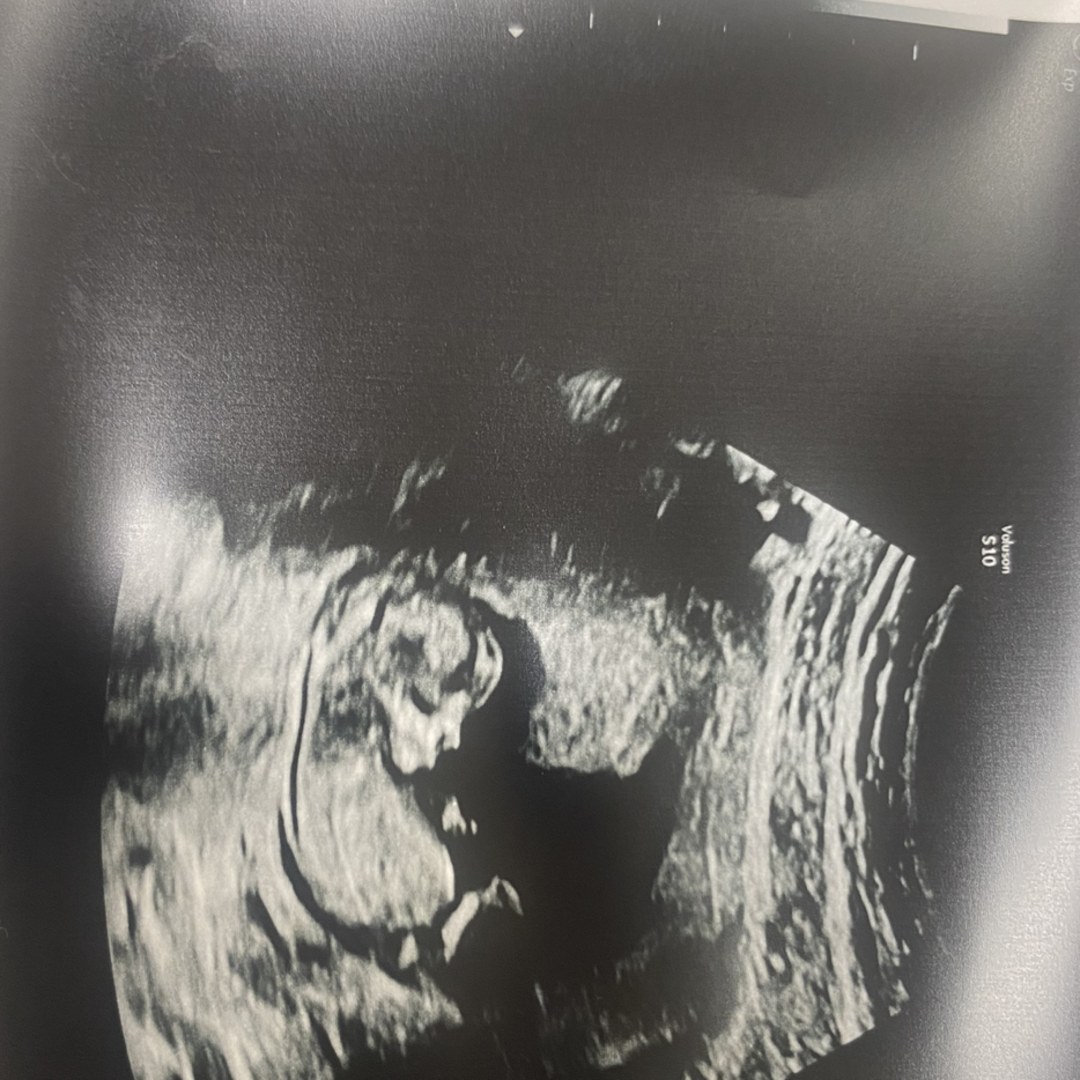 Photo shared by Kaitlyn for their Babylist baby registry.