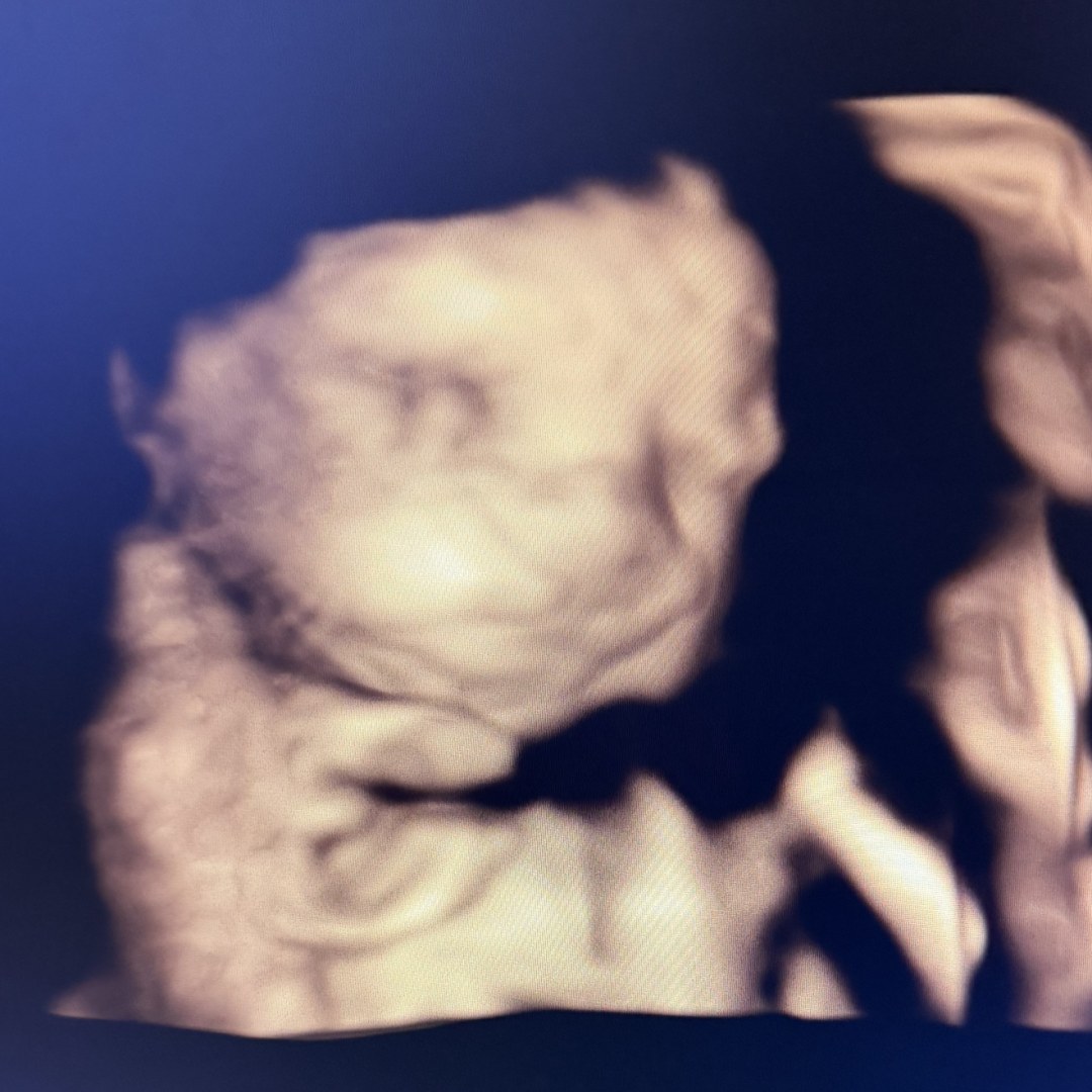 Photo shared by Yesenia for their Babylist baby registry.