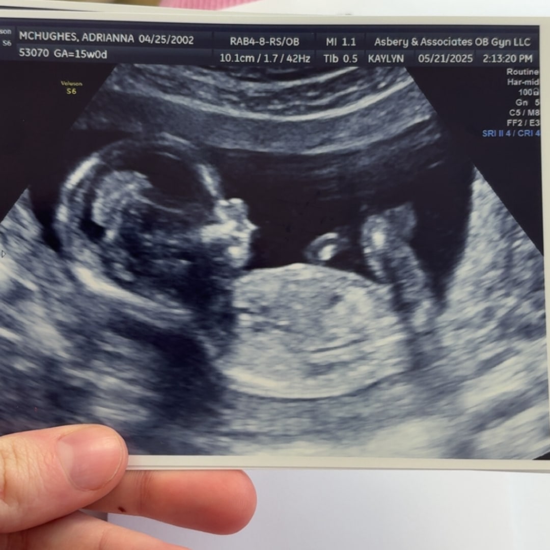 Photo shared by Addie for their Babylist baby registry.