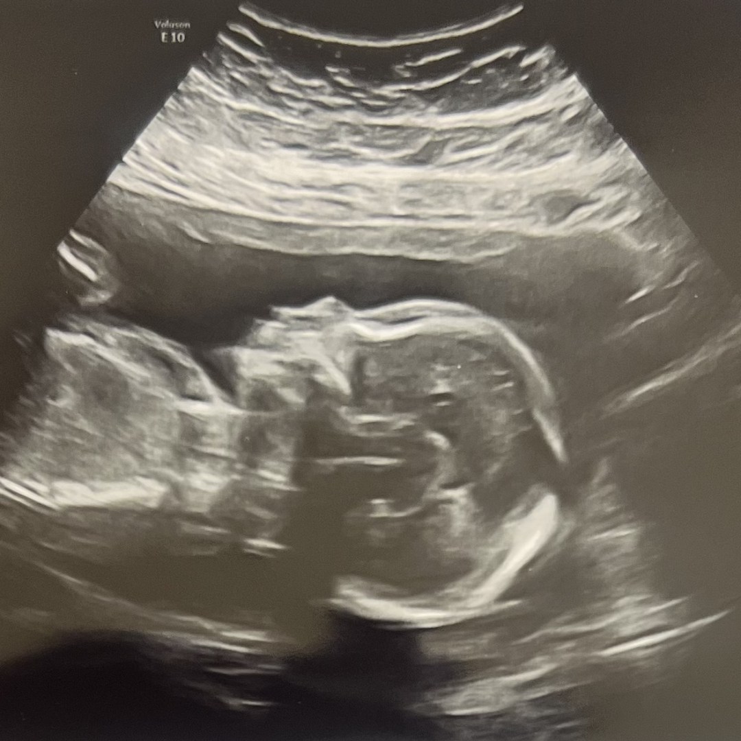 Photo shared by Andrea for their Babylist baby registry.