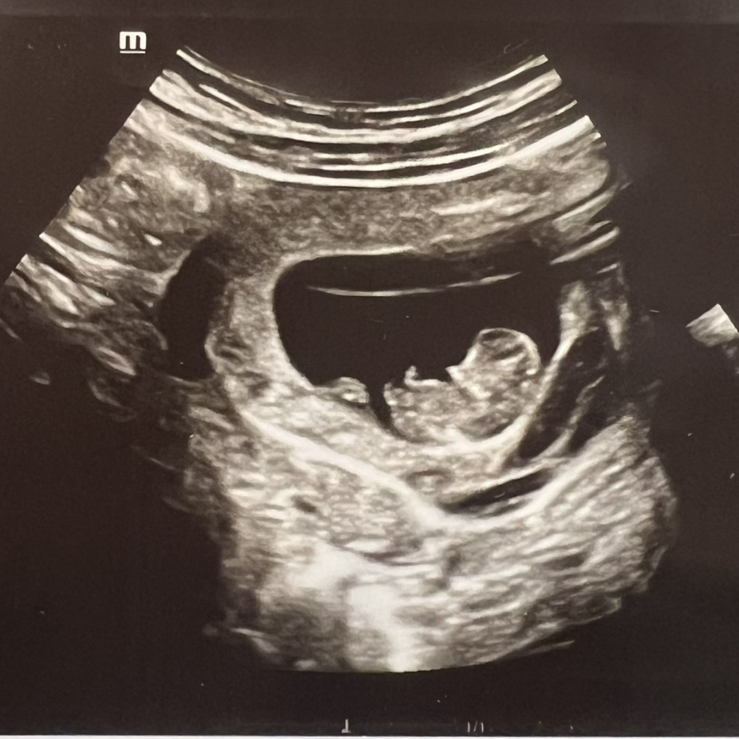 Photo shared by Annabell for their Babylist baby registry.