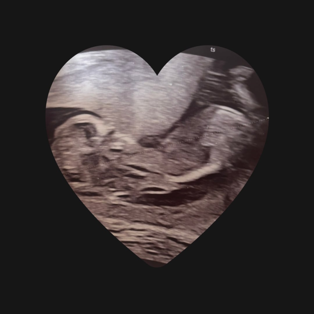 Photo shared by Andrea for their Babylist baby registry.