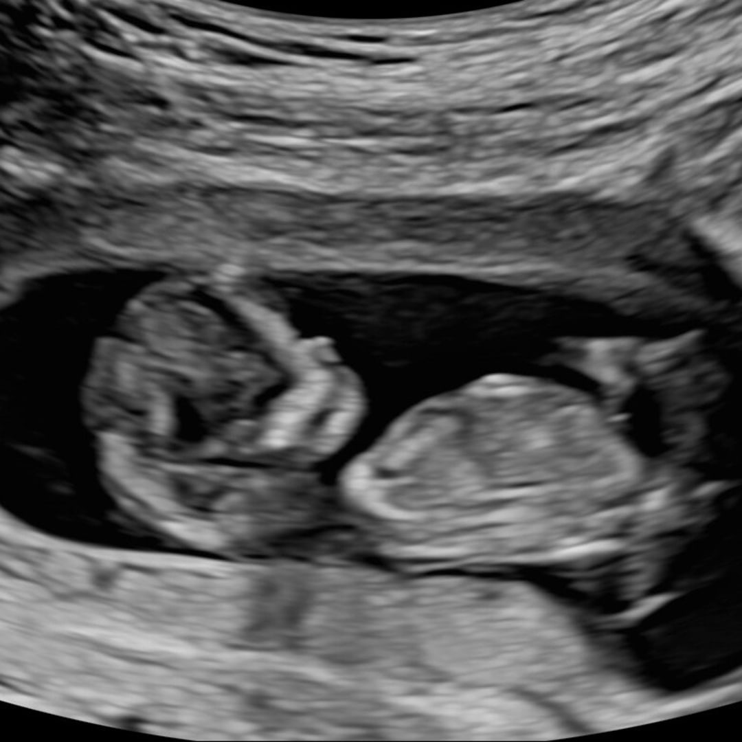 Photo shared by Brooke for their Babylist baby registry.