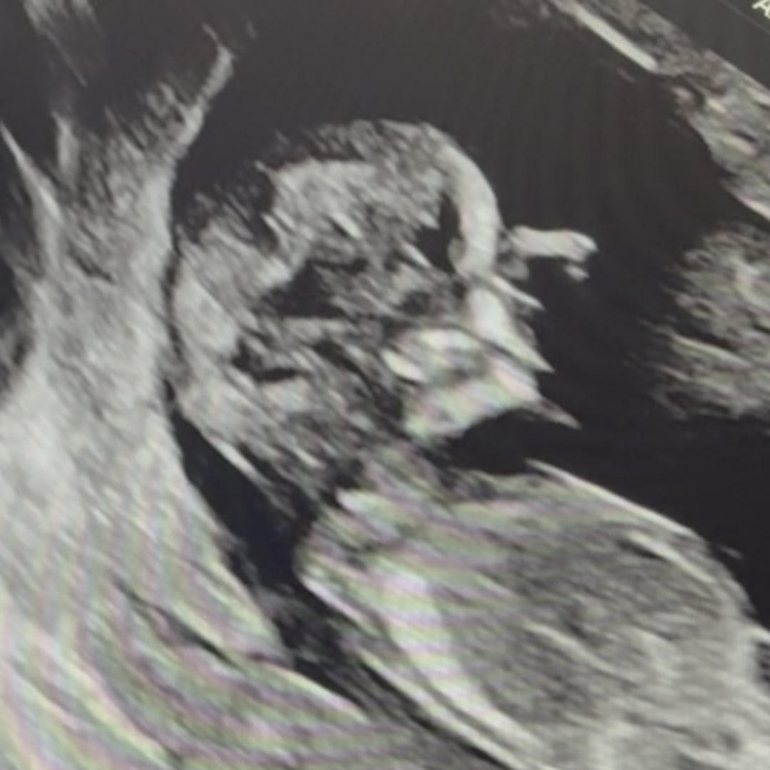 Photo shared by Ashley for their Babylist baby registry.