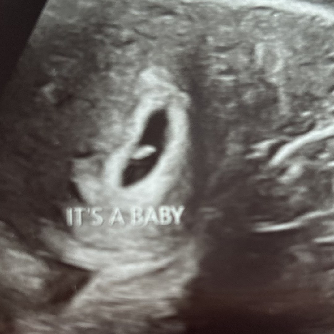 Photo shared by Tiffani for their Babylist baby registry.