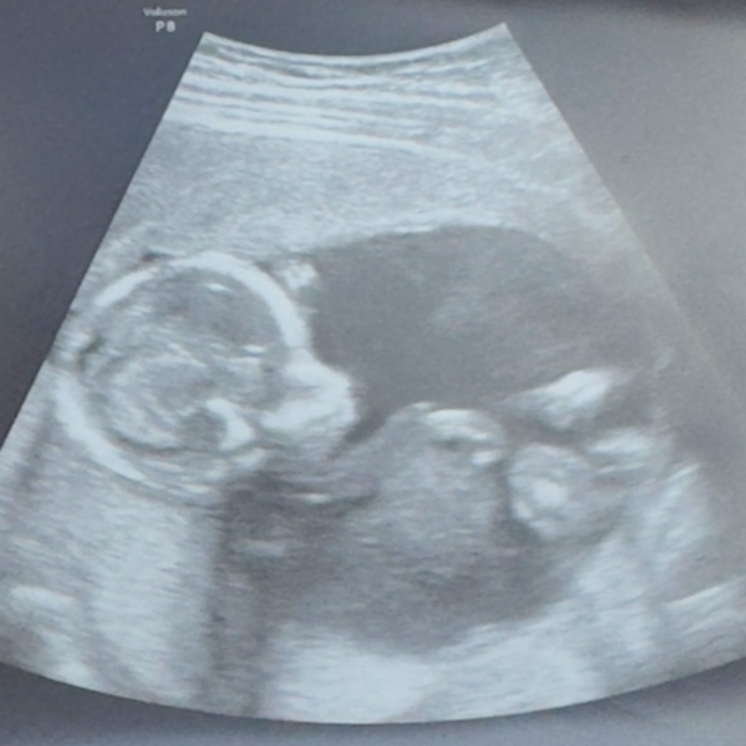 Photo shared by Virginia for their Babylist baby registry.