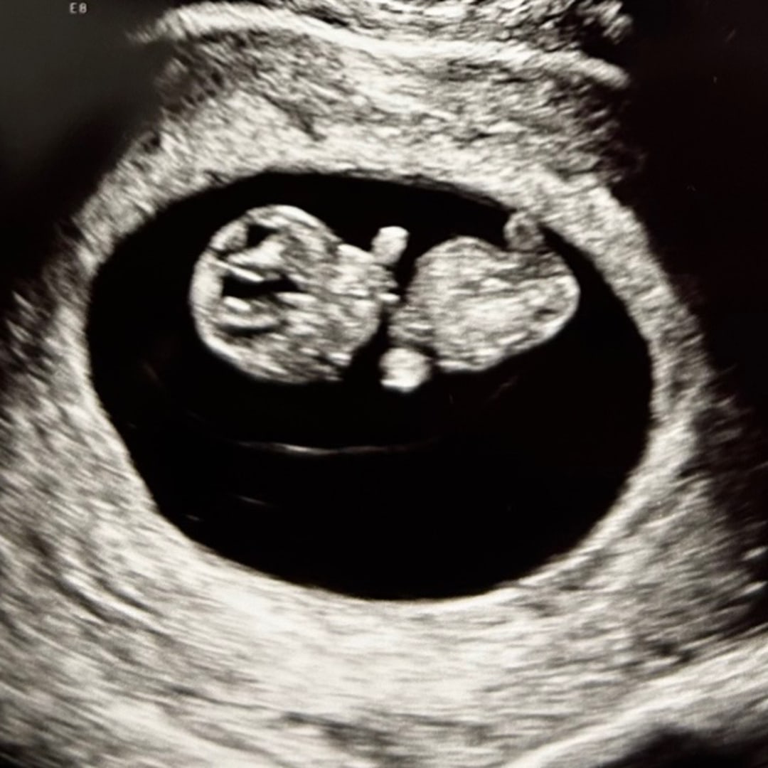Photo shared by Chelsea for their Babylist baby registry.
