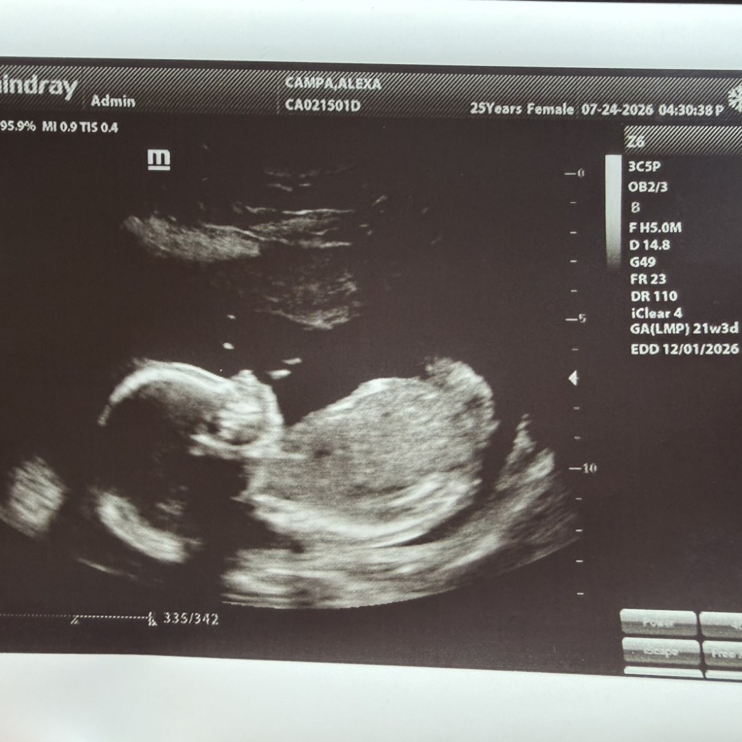 Photo shared by Alexa for their Babylist baby registry.