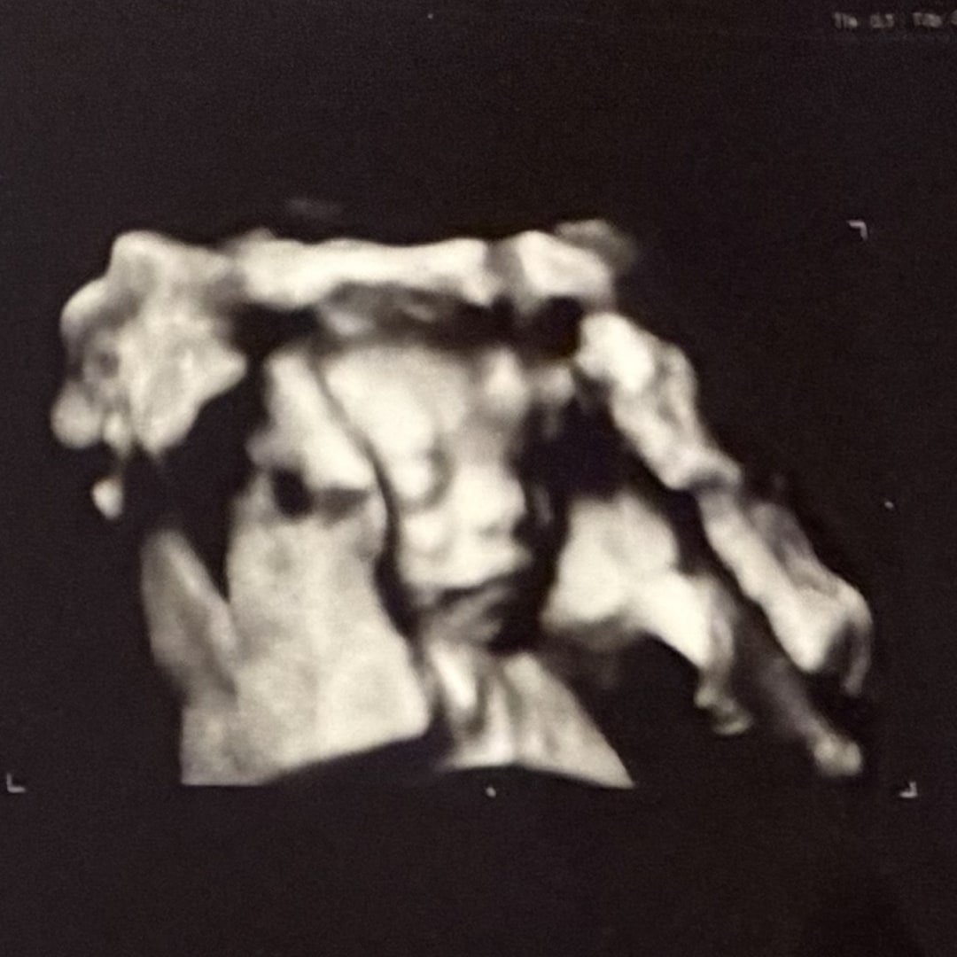 Photo shared by Christina for their Babylist baby registry.