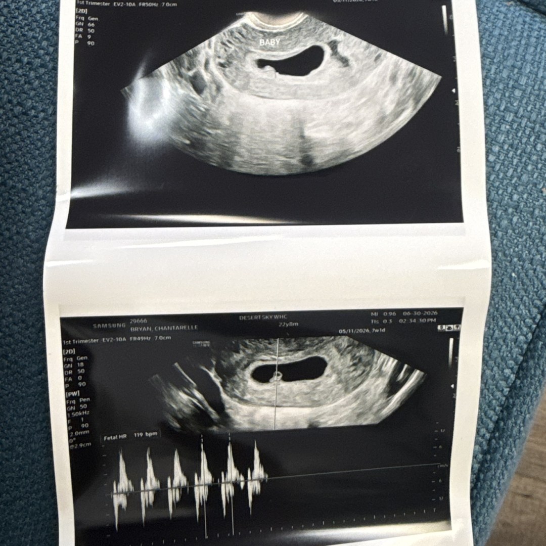 Photo shared by Chanti for their Babylist baby registry.