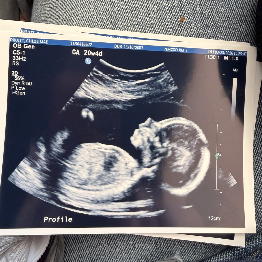 Photo shared by Chloe for their Babylist baby registry.