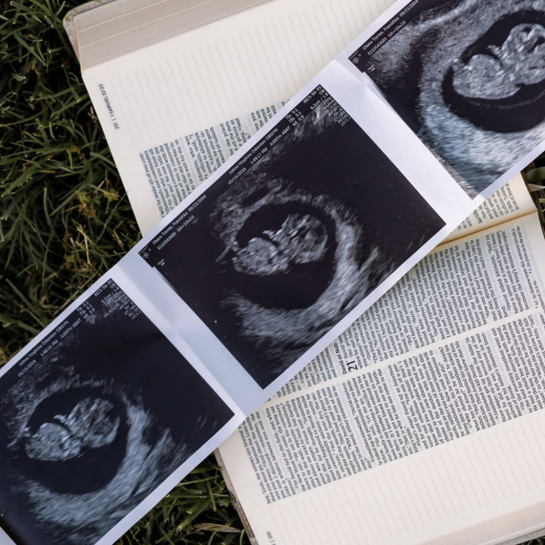 Photo shared by Franishka for their Babylist baby registry.