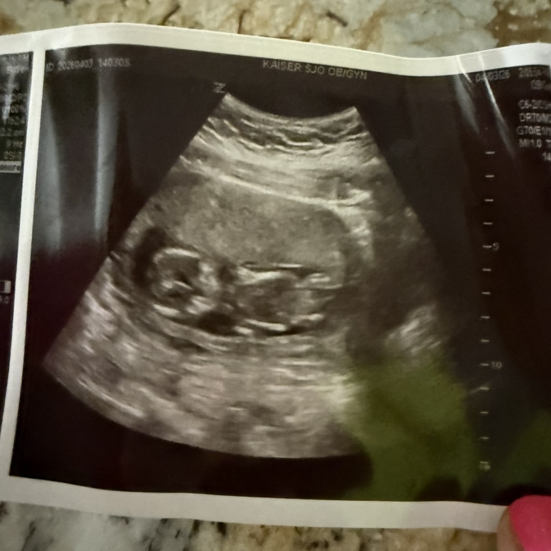 Photo shared by Evelyn for their Babylist baby registry.