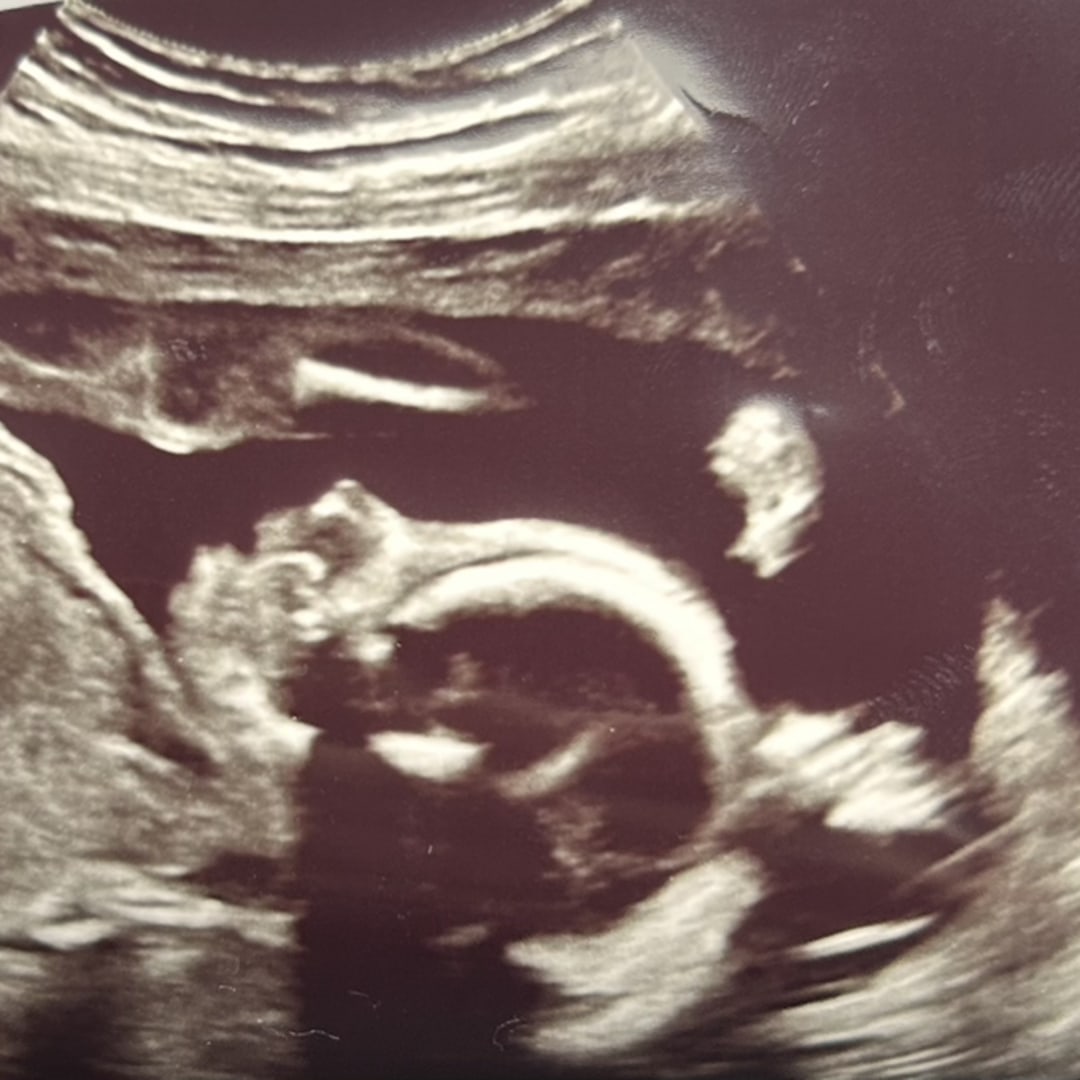 Photo shared by Jessica for their Babylist baby registry.