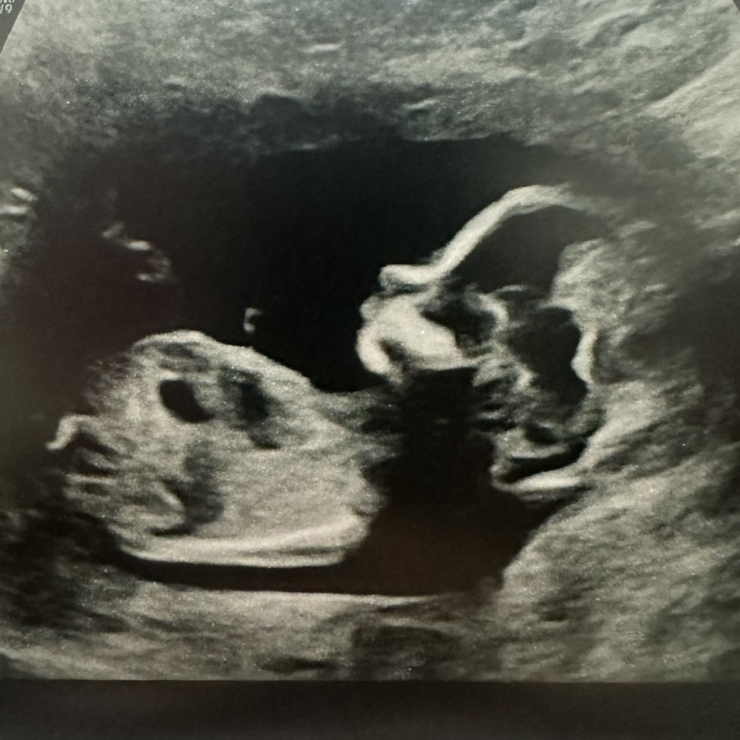 Photo shared by Jocelyn for their Babylist baby registry.