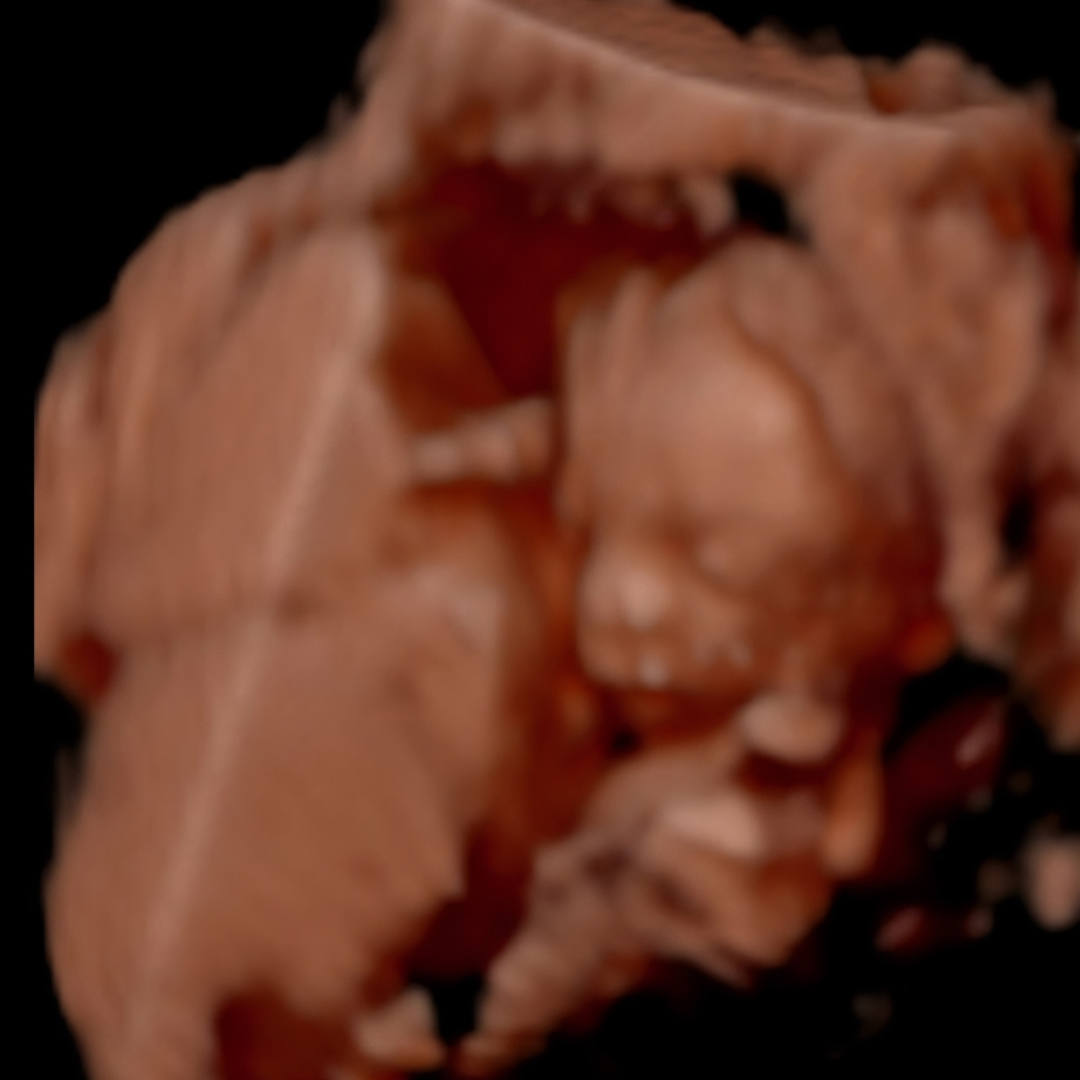 Photo shared by Erika for their Babylist baby registry.