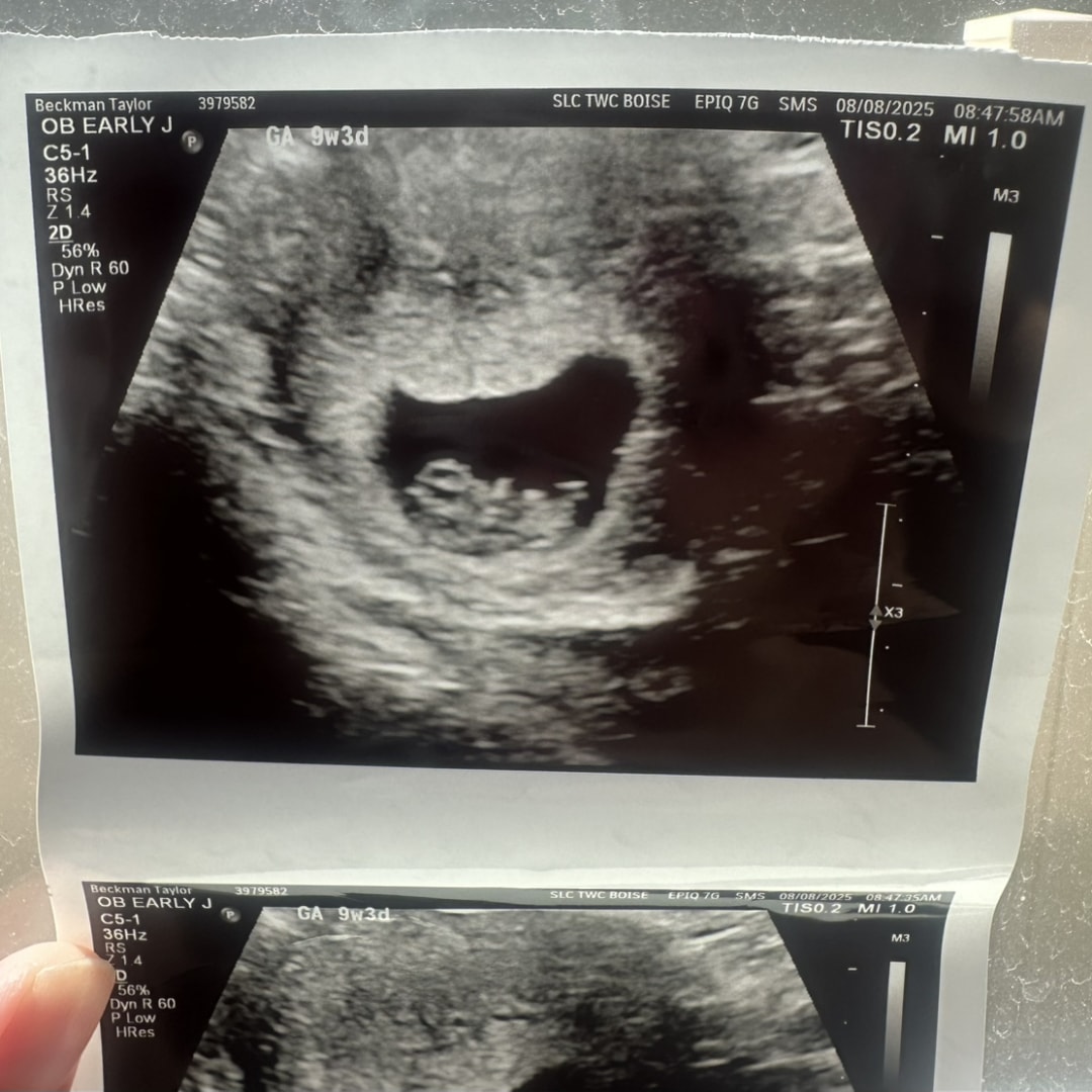 Photo shared by Taylor for their Babylist baby registry.