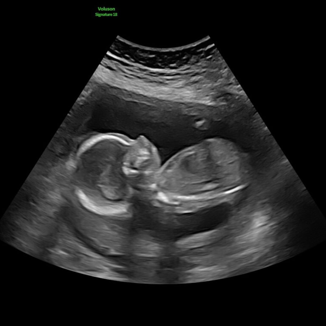 Photo shared by Hannah for their Babylist baby registry.