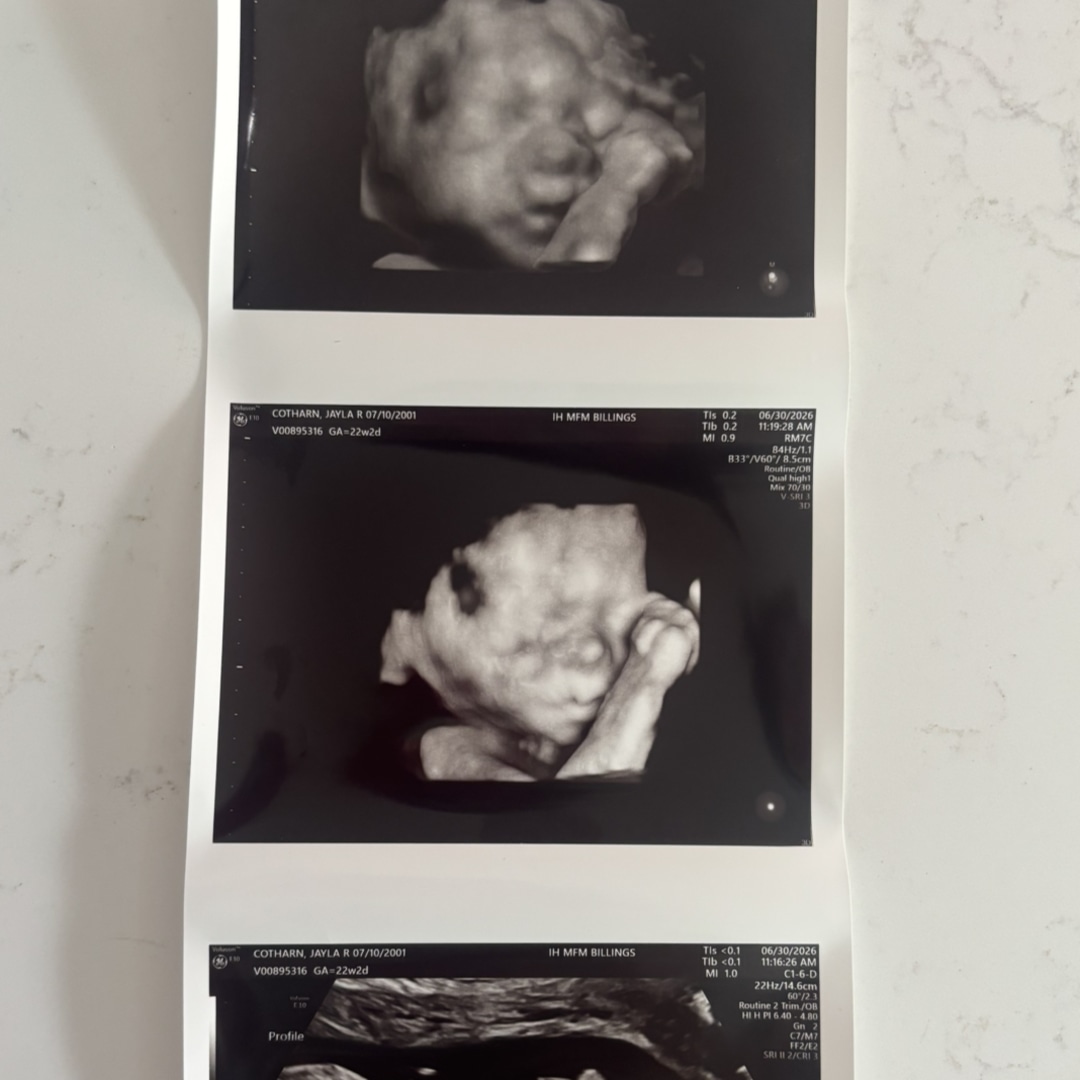 Photo shared by Jayla for their Babylist baby registry.
