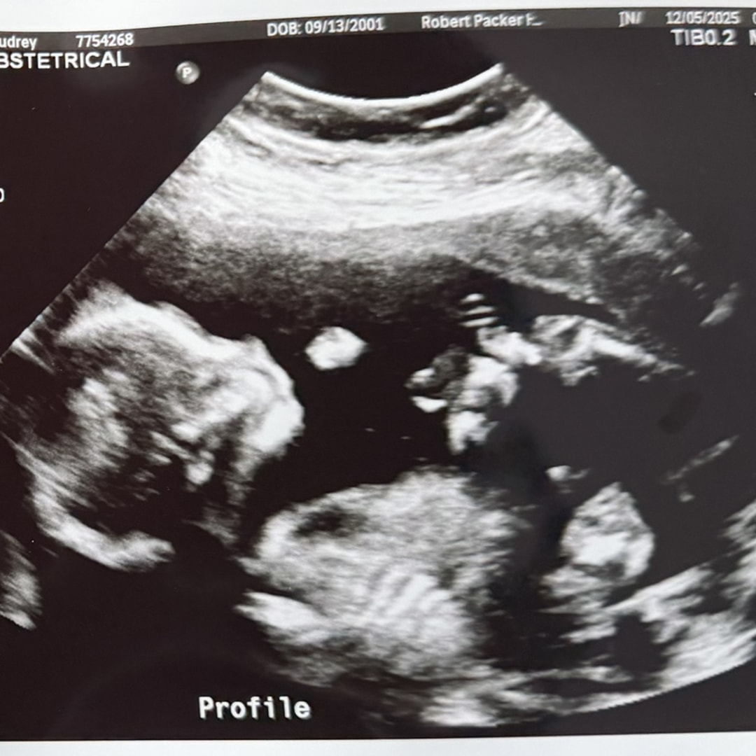 Photo shared by Audrey for their Babylist baby registry.