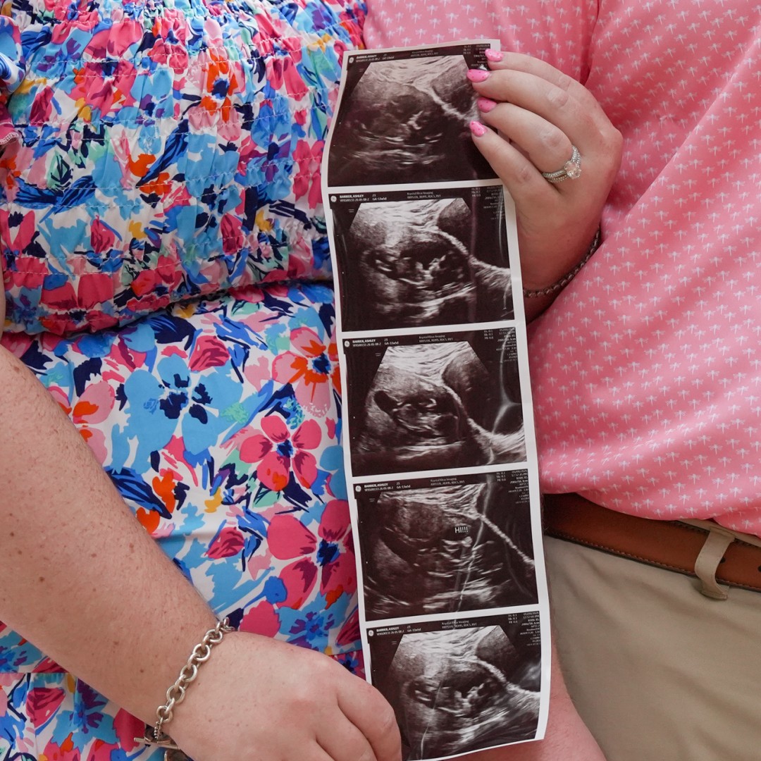 Photo shared by Ashley for their Babylist baby registry.